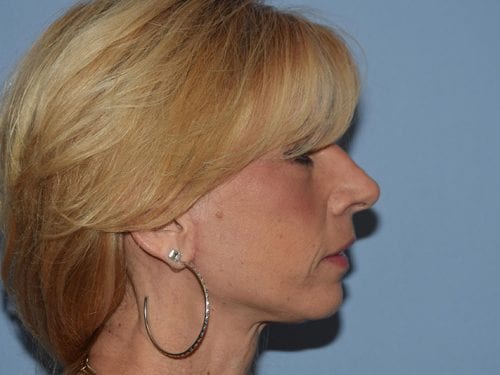 After Image