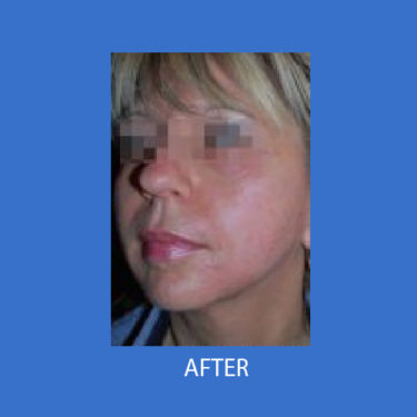 After Image