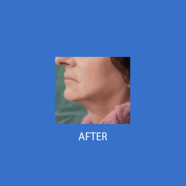 After Image