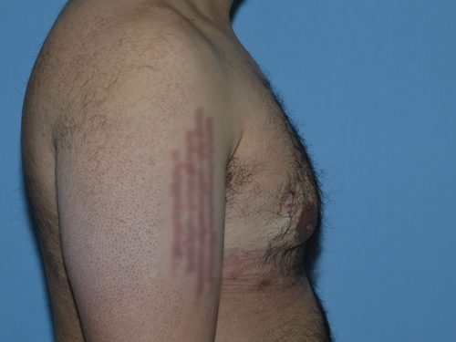 After Image