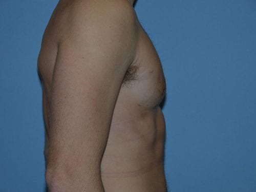 After Image
