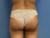 After Image