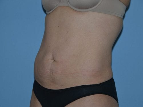 After Image