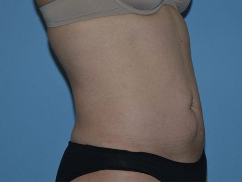After Image