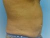 After Image