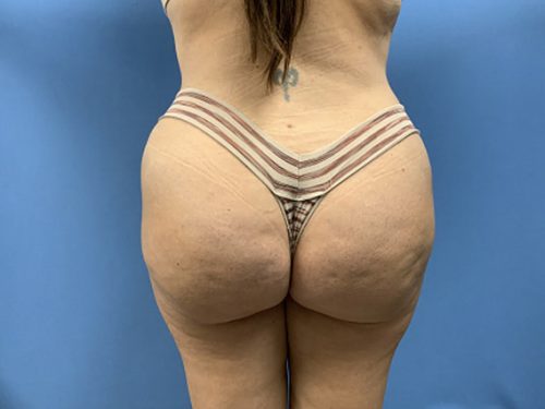 After Image