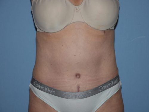 After Image
