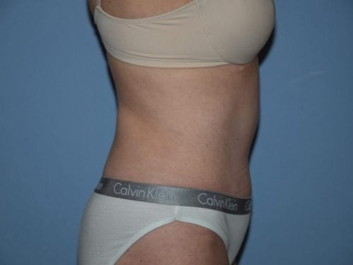 After Image
