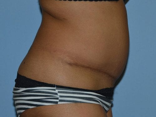 After Image